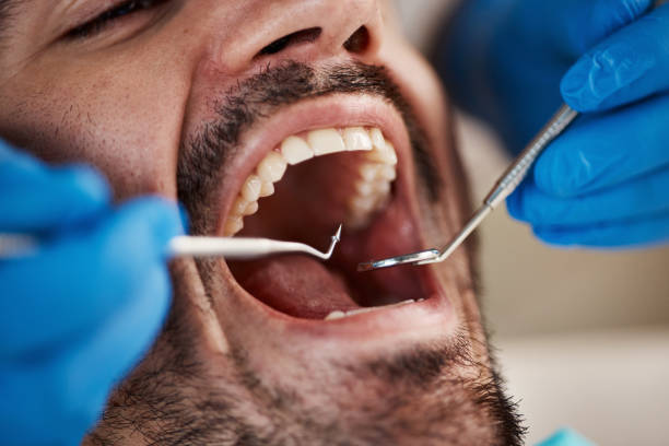 Best Emergency Treatment for Oral Infections in Montpelier, OH