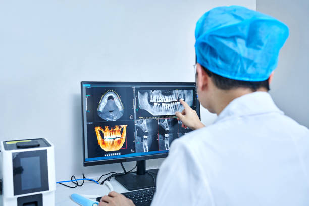 Best Emergency Wisdom Tooth Extraction in Montpelier, OH